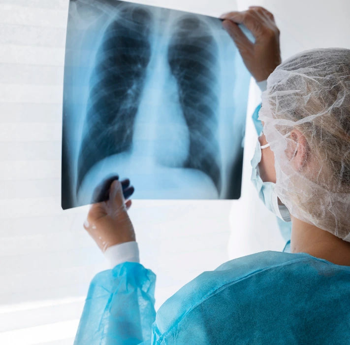 xrays