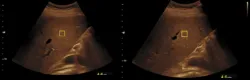 Orthopaedic Joint Model